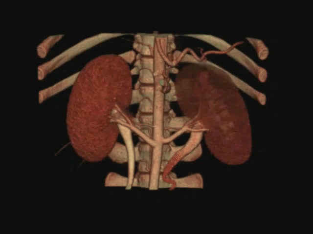 Three-dimensional reconstruction of two kidneys beside the spine and ribs, with renal vessels visible, from a contrast-enhanced CT scan against a black background. In the animated version a tomographic slice passes through the kidneys to reveal their internal structure.